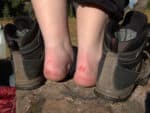 How to prevent blisters from steel toe boots