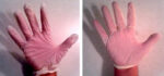 Should Disposable Gloves Be Loose Fitting or Close Fitting